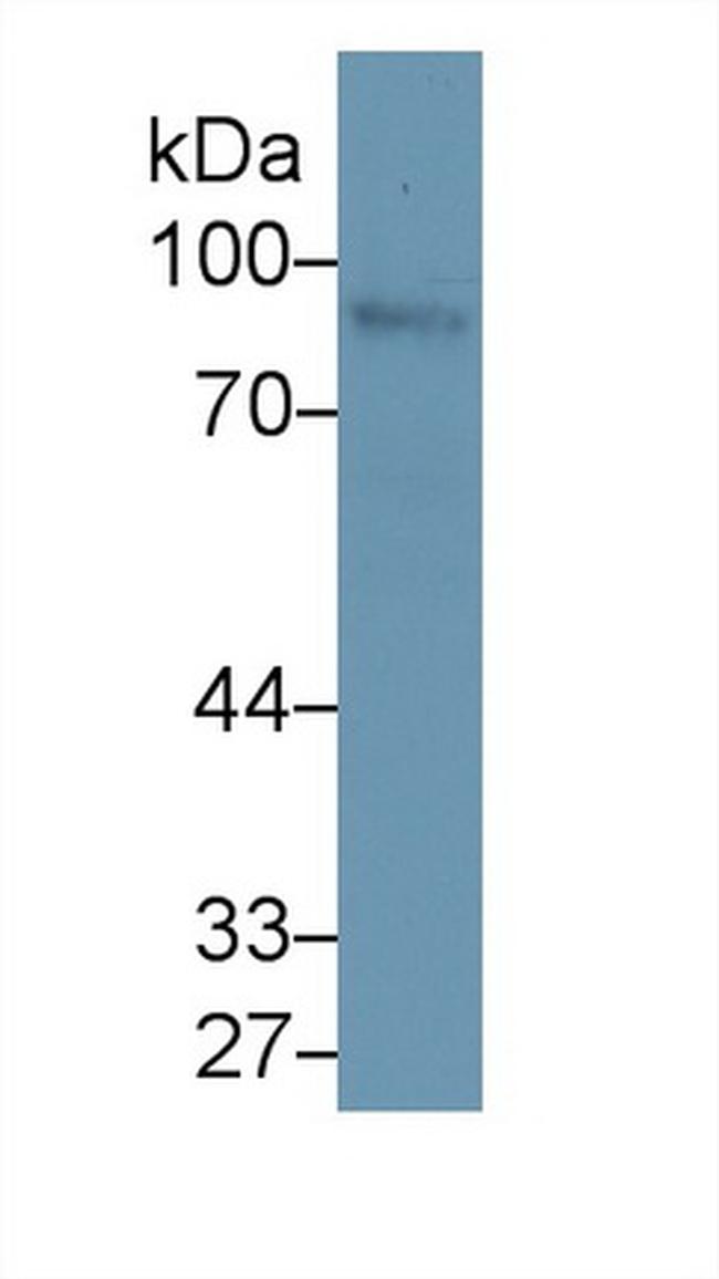 Nexilin Antibody in Western Blot (WB)