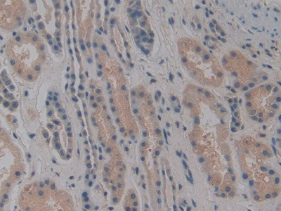 NOSIP Antibody in Immunohistochemistry (Paraffin) (IHC (P))