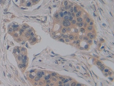 NOSIP Antibody in Immunohistochemistry (Paraffin) (IHC (P))