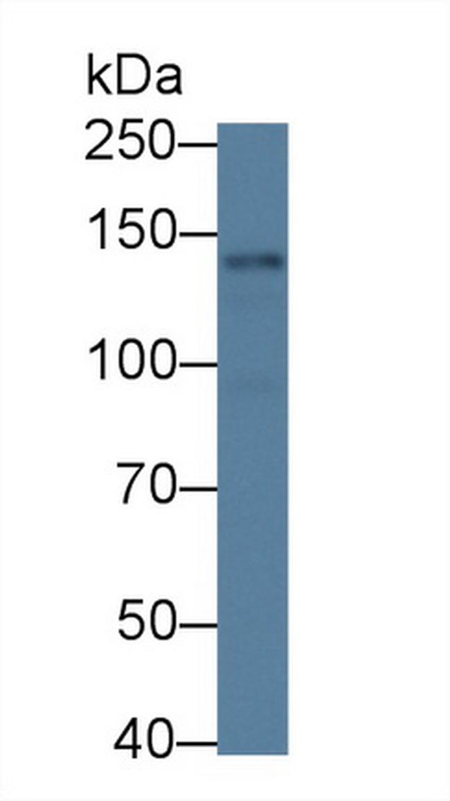 NLRP3 Antibody in Western Blot (WB)