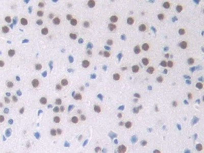 NPM1 Antibody in Immunohistochemistry (Paraffin) (IHC (P))