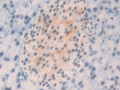 NPM1 Antibody in Immunohistochemistry (Paraffin) (IHC (P))