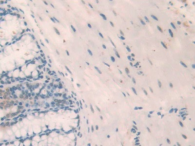 NPM1 Antibody in Immunohistochemistry (Paraffin) (IHC (P))