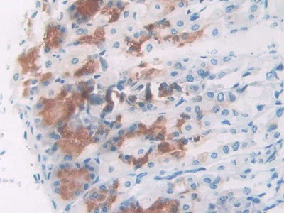 NPM1 Antibody in Immunohistochemistry (Paraffin) (IHC (P))