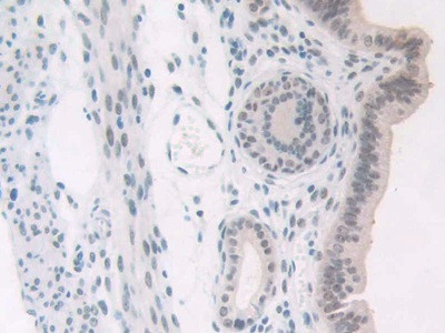 NPM1 Antibody in Immunohistochemistry (Paraffin) (IHC (P))