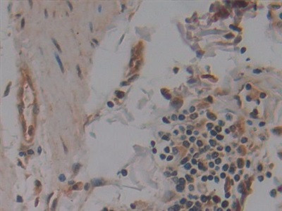 NUP155 Antibody in Immunohistochemistry (Paraffin) (IHC (P))