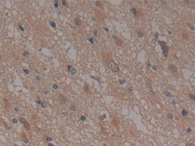 NUP155 Antibody in Immunohistochemistry (Paraffin) (IHC (P))