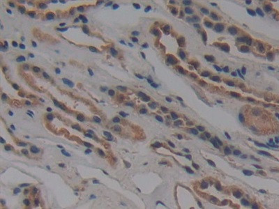 NUP155 Antibody in Immunohistochemistry (Paraffin) (IHC (P))