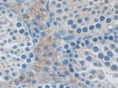 NXN Antibody in Immunohistochemistry (Paraffin) (IHC (P))