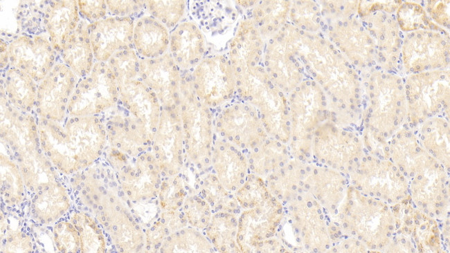 NUMB Antibody in Immunohistochemistry (Paraffin) (IHC (P))