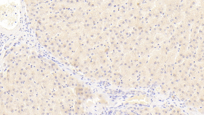 NUMB Antibody in Immunohistochemistry (Paraffin) (IHC (P))