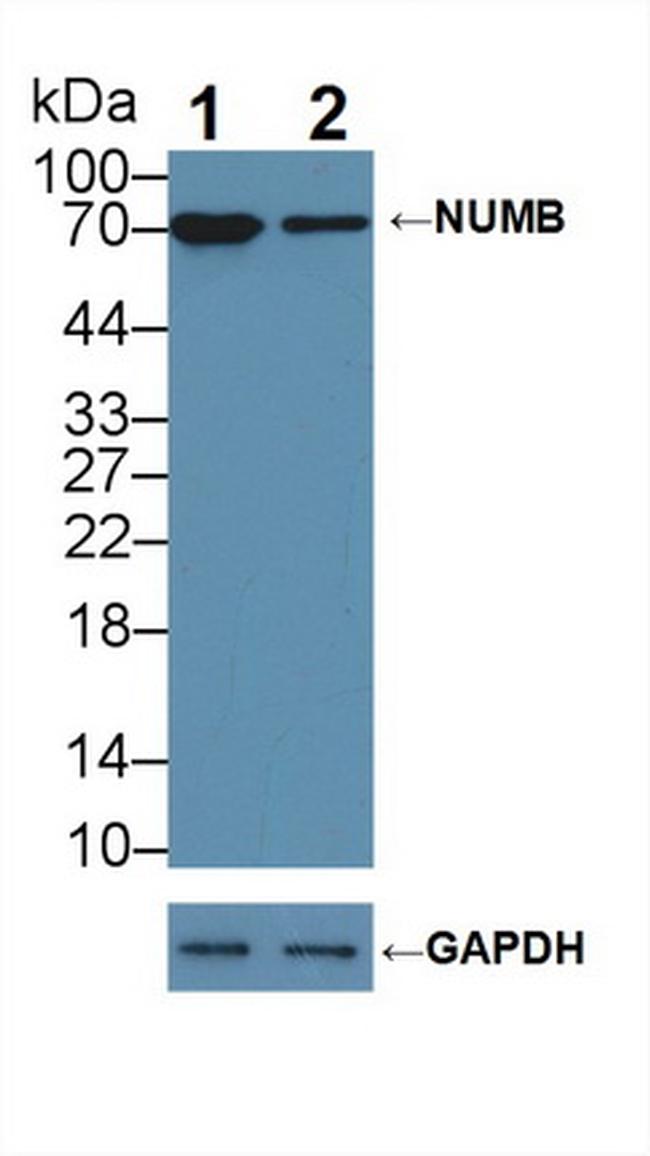 NUMB Antibody in Western Blot (WB)