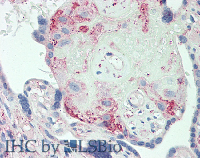 ORM2 Antibody in Immunohistochemistry (Paraffin) (IHC (P))