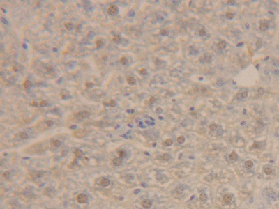 ORM2 Antibody in Immunohistochemistry (Paraffin) (IHC (P))