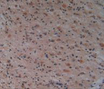 PAK1 Antibody in Immunohistochemistry (Paraffin) (IHC (P))