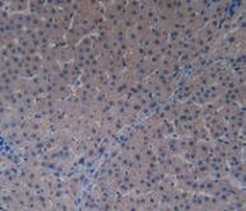 PAK1 Antibody in Immunohistochemistry (Paraffin) (IHC (P))