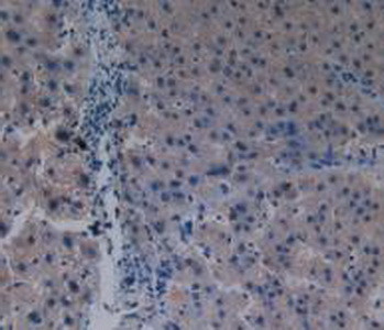 PAK1 Antibody in Immunohistochemistry (Paraffin) (IHC (P))