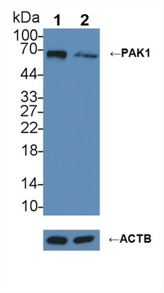 PAK1 Antibody in Western Blot (WB)