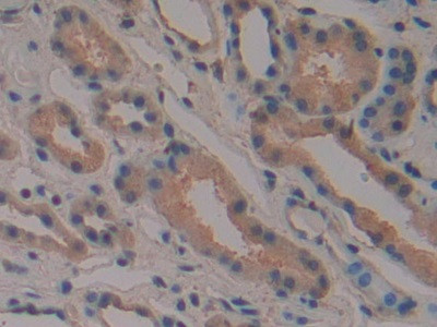 PAK2 Antibody in Immunohistochemistry (Paraffin) (IHC (P))