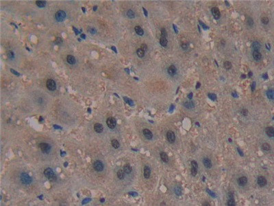 PAK2 Antibody in Immunohistochemistry (Paraffin) (IHC (P))