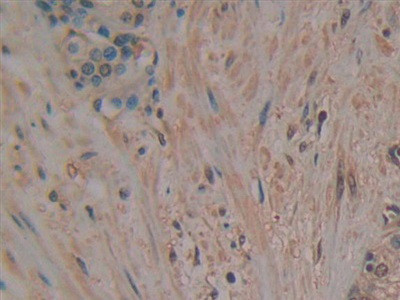 PAK2 Antibody in Immunohistochemistry (Paraffin) (IHC (P))