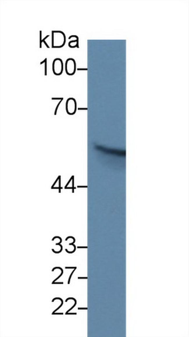 PAK2 Antibody in Western Blot (WB)