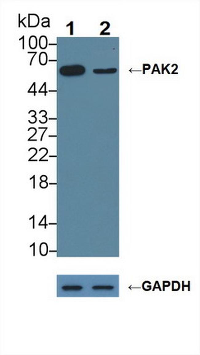 PAK2 Antibody in Western Blot (WB)