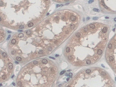 Palladin Antibody in Immunohistochemistry (Paraffin) (IHC (P))