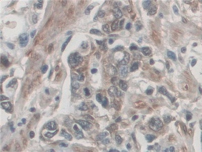 Palladin Antibody in Immunohistochemistry (Paraffin) (IHC (P))