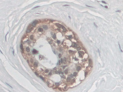 Palladin Antibody in Immunohistochemistry (Paraffin) (IHC (P))