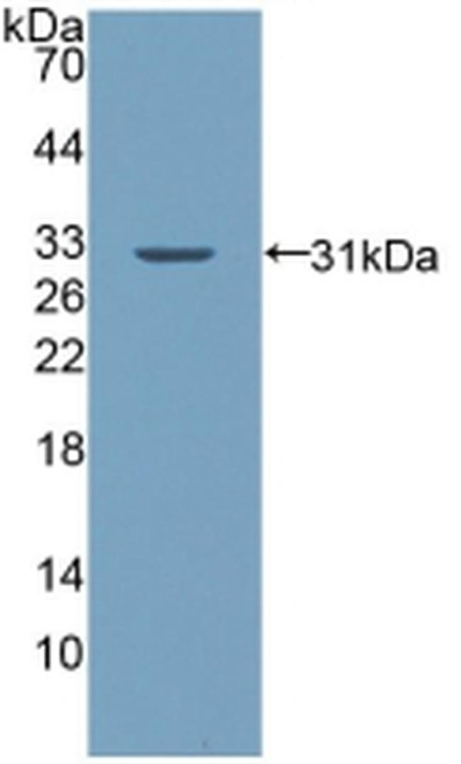 Palladin Antibody in Western Blot (WB)