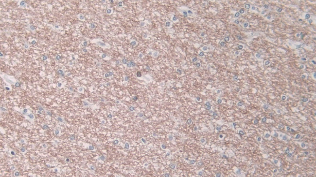 CELA1 Antibody in Immunohistochemistry (Paraffin) (IHC (P))