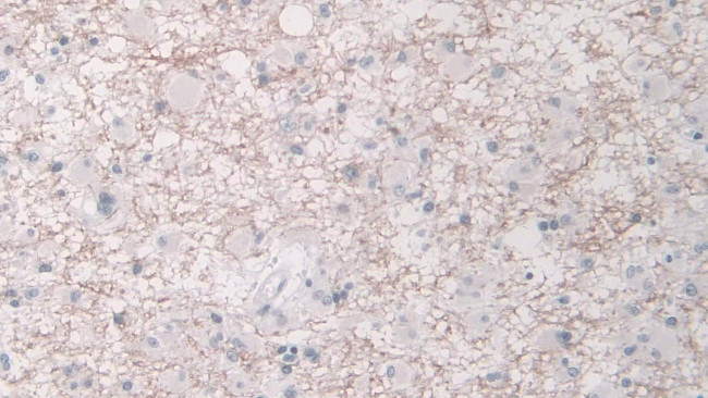 CELA1 Antibody in Immunohistochemistry (Paraffin) (IHC (P))