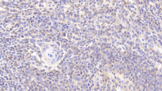 DJ-1 Antibody in Immunohistochemistry (Paraffin) (IHC (P))