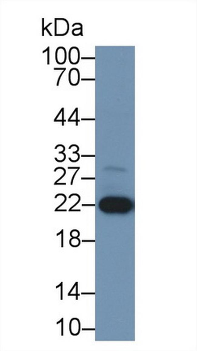 DJ-1 Antibody in Western Blot (WB)