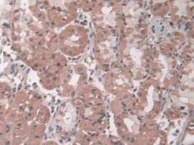 Pepsin Antibody in Immunohistochemistry (Paraffin) (IHC (P))