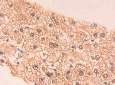 PAH Antibody in Immunohistochemistry (Paraffin) (IHC (P))