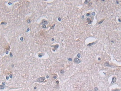 PGK1 Antibody in Immunohistochemistry (Paraffin) (IHC (P))