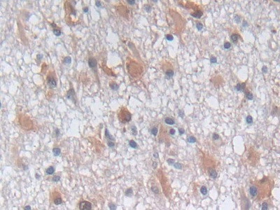 PGK1 Antibody in Immunohistochemistry (Paraffin) (IHC (P))