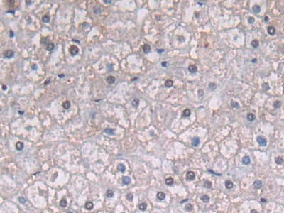 PGK1 Antibody in Immunohistochemistry (Paraffin) (IHC (P))