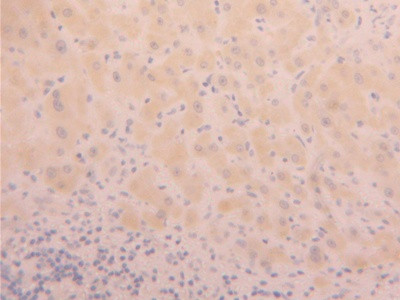 PHPT1 Antibody in Immunohistochemistry (Paraffin) (IHC (P))