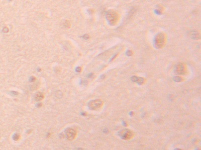 PHPT1 Antibody in Immunohistochemistry (Paraffin) (IHC (P))