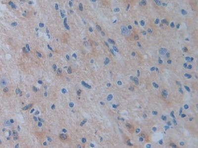 PSAT1 Antibody in Immunohistochemistry (Paraffin) (IHC (P))