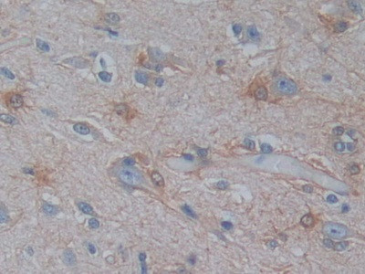 PSAT1 Antibody in Immunohistochemistry (Paraffin) (IHC (P))