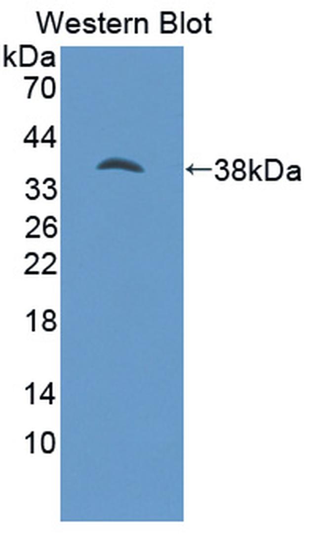 PSAT1 Antibody in Western Blot (WB)