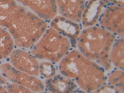 LGALS13 Antibody in Immunohistochemistry (Paraffin) (IHC (P))