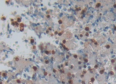 LGALS13 Antibody in Immunohistochemistry (Paraffin) (IHC (P))