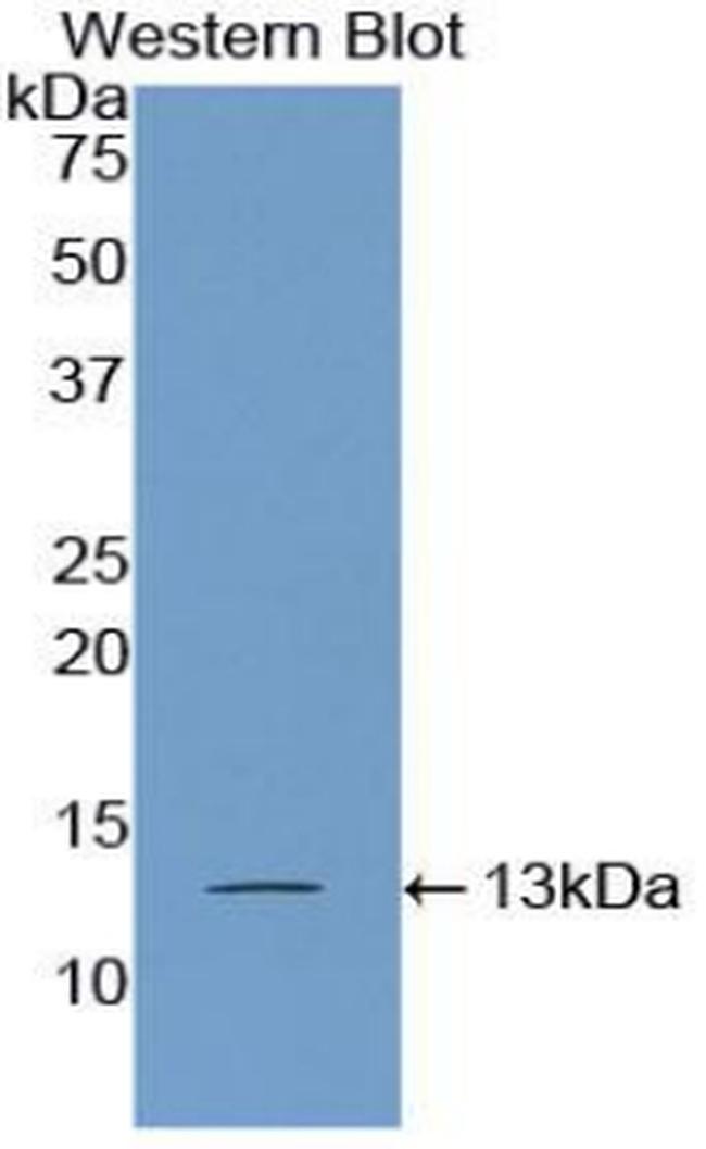 PABPC1L Antibody in Western Blot (WB)