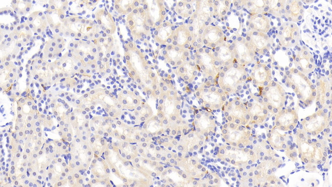 PZP Antibody in Immunohistochemistry (Paraffin) (IHC (P))