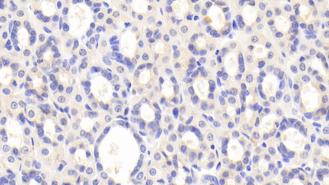 PZP Antibody in Immunohistochemistry (Paraffin) (IHC (P))